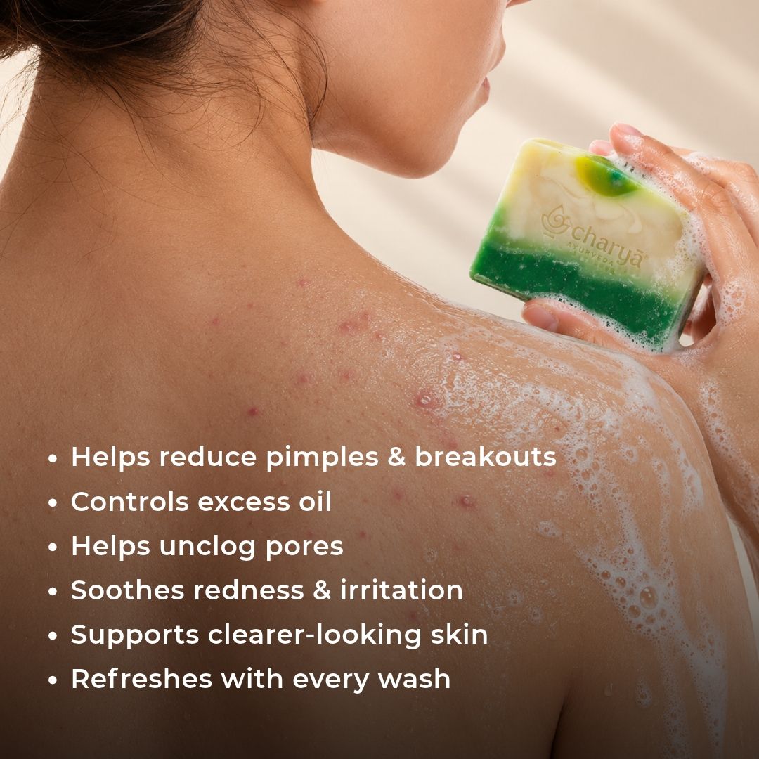 Neem & Nagarmotha Anti-Acne Soap